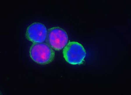 JCB：细胞核内钙信号可改变T细胞应答有助开发免疫抑制疗法